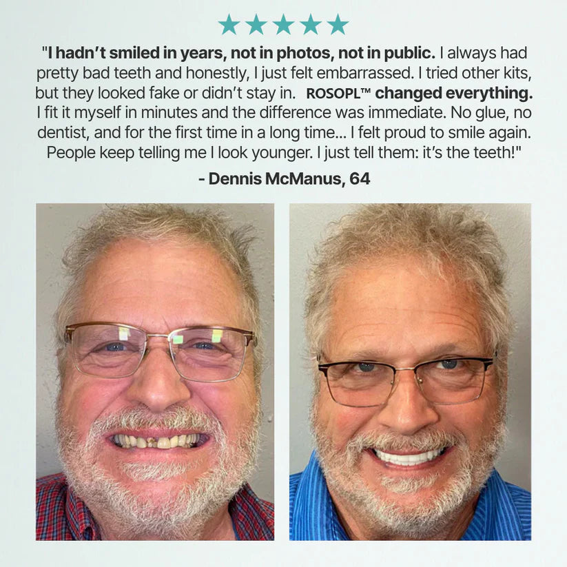 🔥🔥🔥Ends Today: 70% OFF!🦷BRONY™ Custom-Fit Full Functional Dentures Make you more confident