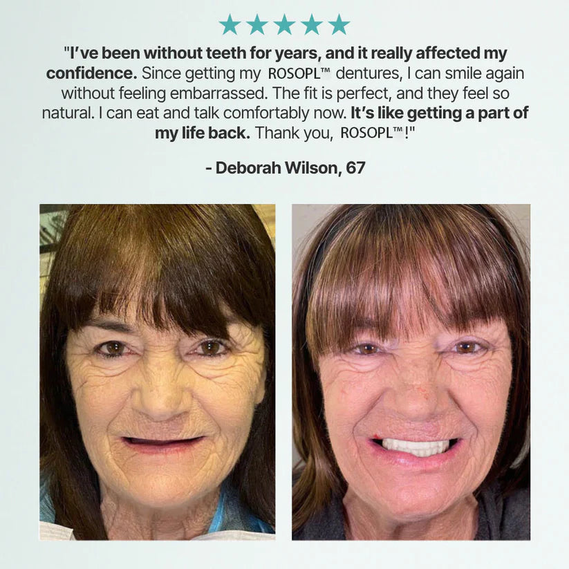 🔥🔥🔥Ends Today: 70% OFF!🦷BRONY™ Custom-Fit Full Functional Dentures Make you more confident