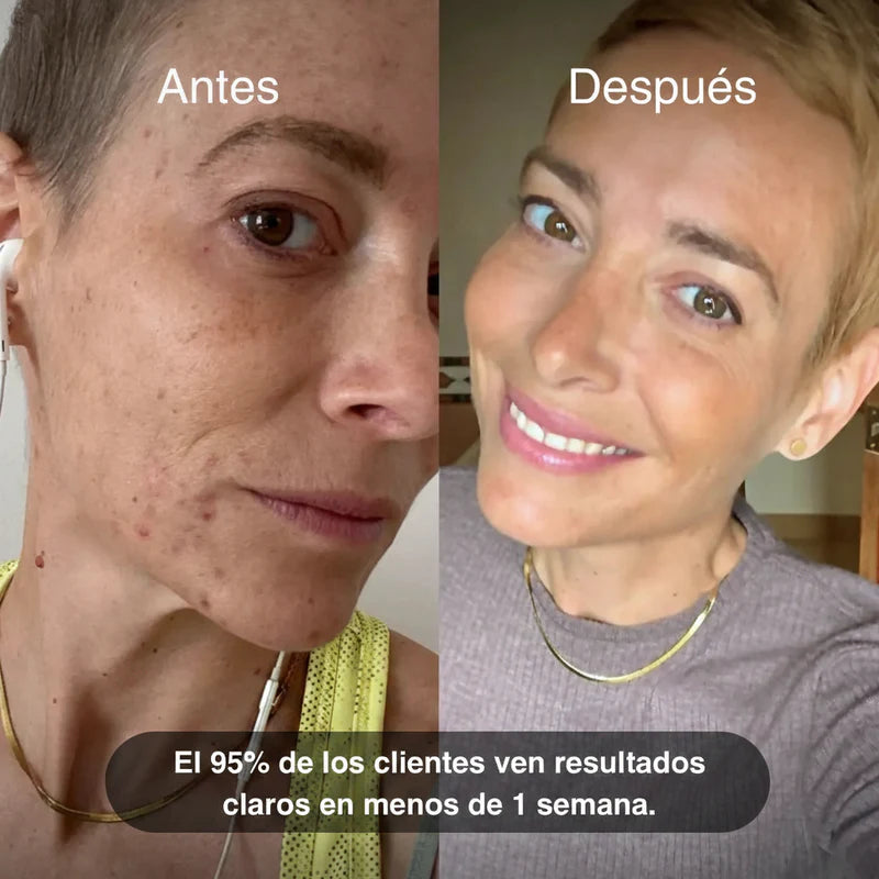 Achieve luminous, smooth skin, free from redness