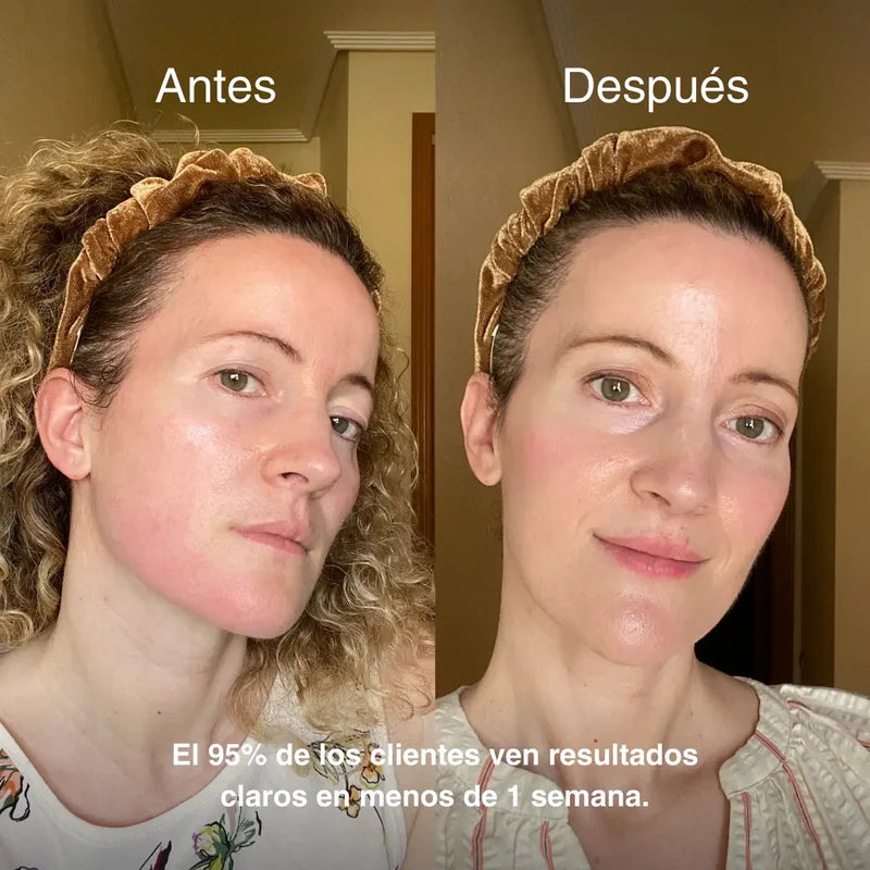 Achieve luminous, smooth skin, free from redness